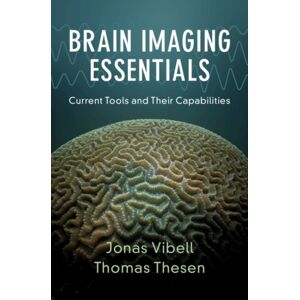 Cambridge University Press Brain Imaging Essentials : Current Tools And Their Capabilities Cambridge University Press Brain Imaging Essentials : Current Tools And Their Capabilities