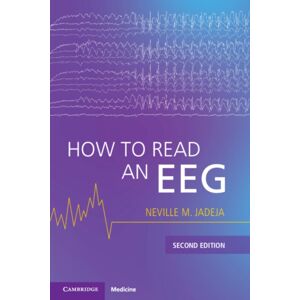 Cambridge University Press How To Read An Eeg Cambridge University Press How To Read An Eeg