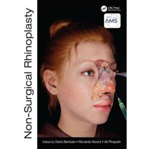 Taylor & Francis Ltd Non-Surgical Rhinoplasty Taylor & Francis Ltd Non-Surgical Rhinoplasty