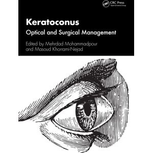 Taylor & Francis Ltd Keratoconus : Optical And Surgical Management Taylor & Francis Ltd Keratoconus : Optical And Surgical Management