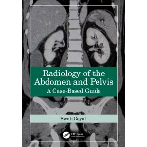 Taylor & Francis Ltd Radiology Of The Abdomen And Pelvis : A Case-Based Guide Taylor & Francis Ltd Radiology Of The Abdomen And Pelvis : A Case-Based Guide