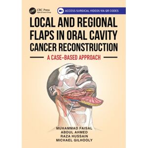 Taylor & Francis Ltd Local And Regional Flaps In Oral Cavity Cancer Reconstruction : A Case-Based Approach Taylor & Francis Ltd Local And Regional Flaps In Oral Cavity Cancer Reconstruction : A Case-Based Approach