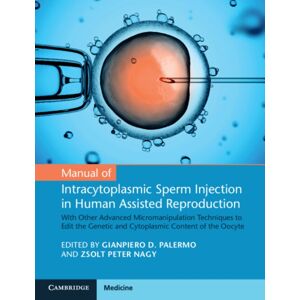 Cambridge University Press Manual Of Intracytoplasmic Sperm Injection In Human Assisted Reproduction : With Other Advanced Micromanipulation Techniques To Edit The Genetic And Cytoplasmic Content Of The Oocyte Cambridge University Press Manual Of Intracytoplasmic Sperm Injection In Human Assisted Reproduction : With Other Advanced Micromanipulation Techniques To Edit The Genetic And Cytoplasmic Content Of The Oocyte