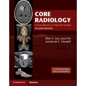 Cambridge University Press Core Radiology : A Visual Approach To Diagnostic Imaging Cambridge University Press Core Radiology : A Visual Approach To Diagnostic Imaging