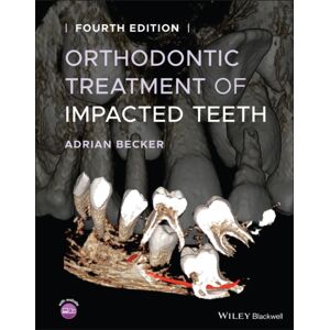 John Wiley and Sons Ltd Orthodontic Treatment Of Impacted Teeth John Wiley and Sons Ltd Orthodontic Treatment Of Impacted Teeth