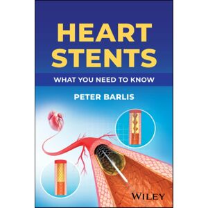 John Wiley & Sons Inc Heart Stents : What You Need To Know John Wiley & Sons Inc Heart Stents : What You Need To Know