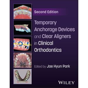 Temporary Anchorage Devices And Clear Aligners In Clinical Orthodontics Temporary Anchorage Devices And Clear Aligners In Clinical Orthodontics