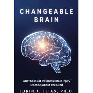 The Dundurn Group Broken Brains : How Landmark Cases Of Traumatic Brain Injuries Changed Our Understanding Of The Mind The Dundurn Group Broken Brains : How Landmark Cases Of Traumatic Brain Injuries Changed Our Understanding Of The Mind