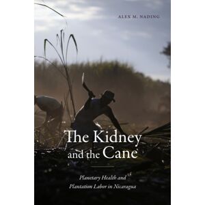 Duke University Press The Kidney And The Cane : Planetary Health And Plantation Labor In Nicaragua Duke University Press The Kidney And The Cane : Planetary Health And Plantation Labor In Nicaragua