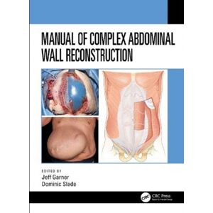 Taylor & Francis Inc Manual Of Complex Abdominal Wall Reconstruction Taylor & Francis Inc Manual Of Complex Abdominal Wall Reconstruction