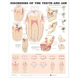 Anatomical Chart Co. Disorders Of The Teeth And Jaw Anatomical Chart Anatomical Chart Co. Disorders Of The Teeth And Jaw Anatomical Chart