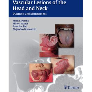 Thieme Medical Publishers Inc Vascular Lesions Of The Head And Neck : Diagnosis And Management Thieme Medical Publishers Inc Vascular Lesions Of The Head And Neck : Diagnosis And Management