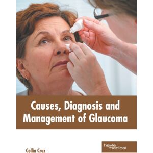 Hayle Medical Causes, Diagnosis And Management Of Glaucoma Hayle Medical Causes, Diagnosis And Management Of Glaucoma
