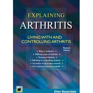 Straightforward Publishing An Emerald Guide To Explaining Arthritis : Living With And Controlling Arthritis Straightforward Publishing An Emerald Guide To Explaining Arthritis : Living With And Controlling Arthritis