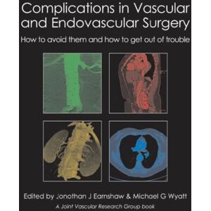 TFM Publishing Ltd Complications In Vascular And Endovascular Surgery : How To Avoid Them And How To Get Out Of Trouble TFM Publishing Ltd Complications In Vascular And Endovascular Surgery : How To Avoid Them And How To Get Out Of Trouble
