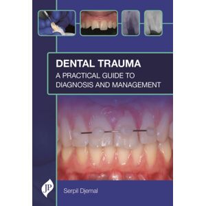 JP Medical Ltd Dental Trauma : A Practical Guide To Diagnosis And Management JP Medical Ltd Dental Trauma : A Practical Guide To Diagnosis And Management
