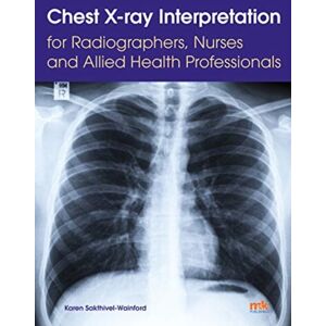 M&K Update Ltd Chest X-Ray Interpretation For Radiographers, Nurses And Allied Health Professionals M&K Update Ltd Chest X-Ray Interpretation For Radiographers, Nurses And Allied Health Professionals