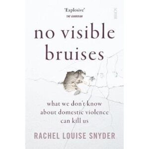 Scribe Publications No Visible Bruises : What We Don’t Know About Domestic Violence Can Kill Us Scribe Publications No Visible Bruises : What We Don’t Know About Domestic Violence Can Kill Us