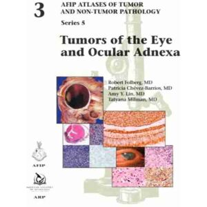 American Registry of Pathology Tumors Of The Eye And Ocular Adnexa American Registry of Pathology Tumors Of The Eye And Ocular Adnexa