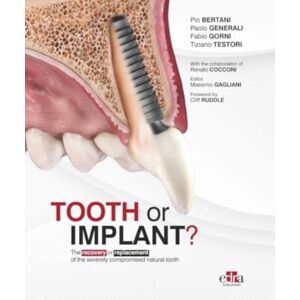 Edra Publishing US LLC Tooth Or Implant Edra Publishing US LLC Tooth Or Implant