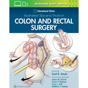Wolters Kluwer Health Cleveland Clinic Illustrated Tips And Tricks In Colon And Rectal Surgery Wolters Kluwer Health Cleveland Clinic Illustrated Tips And Tricks In Colon And Rectal Surgery