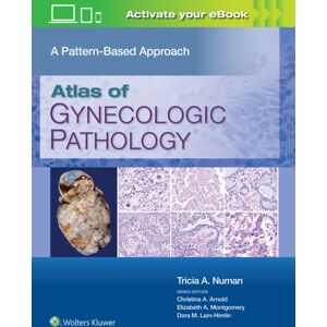 Wolters Kluwer Health Atlas Of Gynecologic Pathology : A Pattern-Based Approach: Print + With Multimedia Wolters Kluwer Health Atlas Of Gynecologic Pathology : A Pattern-Based Approach: Print + With Multimedia