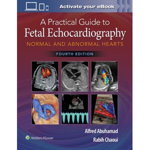 Wolters Kluwer Health A Practical Guide To Fetal Echocardiography : Normal And Abnormal Hearts Wolters Kluwer Health A Practical Guide To Fetal Echocardiography : Normal And Abnormal Hearts