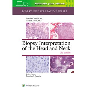 Wolters Kluwer Health Biopsy Interpretation Of The Head And Neck Wolters Kluwer Health Biopsy Interpretation Of The Head And Neck