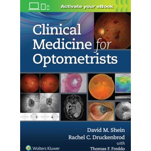 Wolters Kluwer Health Clinical Medicine For Optometrists Wolters Kluwer Health Clinical Medicine For Optometrists