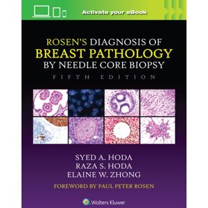 Wolters Kluwer Health Rosen'S Diagnosis Of Breast Pathology By Needle Core Biopsy Wolters Kluwer Health Rosen'S Diagnosis Of Breast Pathology By Needle Core Biopsy