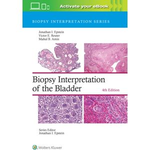 Wolters Kluwer Health Biopsy Interpretation Of The Bladder: Print + With Multimedia Wolters Kluwer Health Biopsy Interpretation Of The Bladder: Print + With Multimedia