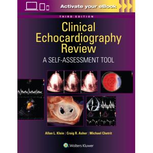 Wolters Kluwer Health Clinical Echocardiography Review : A Self-Assessment Tool: Print + With Multimedia Wolters Kluwer Health Clinical Echocardiography Review : A Self-Assessment Tool: Print + With Multimedia