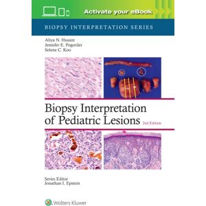 Wolters Kluwer Health Biopsy Interpretation Of Pediatric Lesions: Print + With Multimedia Wolters Kluwer Health Biopsy Interpretation Of Pediatric Lesions: Print + With Multimedia