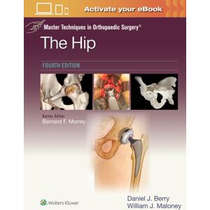 Wolters Kluwer Health Master Techniques In Orthopaedic Surgery: The Hip: Print + With Multimedia Wolters Kluwer Health Master Techniques In Orthopaedic Surgery: The Hip: Print + With Multimedia