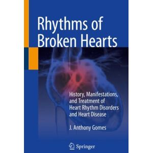 Springer Nature Switzerland AG Rhythms Of Broken Hearts : History, Manifestations, And Treatment Of Heart Rhythm Disorders And Heart Disease Springer Nature Switzerland AG Rhythms Of Broken Hearts : History, Manifestations, And Treatment Of Heart Rhythm Disorders And Heart Disease
