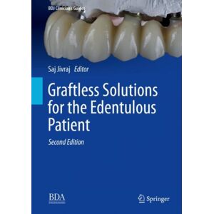 Springer International Publishing AG Graftless Solutions For The Edentulous Patient Springer International Publishing AG Graftless Solutions For The Edentulous Patient