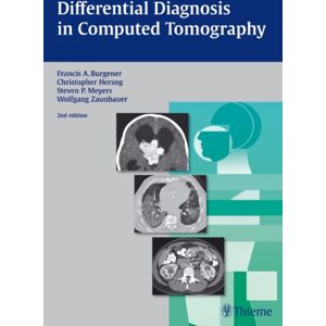 Thieme Publishing Group Differential Diagnosis In Computed Tomography Thieme Publishing Group Differential Diagnosis In Computed Tomography