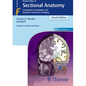 Thieme Publishing Group Pocket Atlas Of Sectional Anatomy, Volume I: Head And Neck : Computed Tomography And Magnetic Resonance Imaging Thieme Publishing Group Pocket Atlas Of Sectional Anatomy, Volume I: Head And Neck : Computed Tomography And Magnetic Resonance Imaging