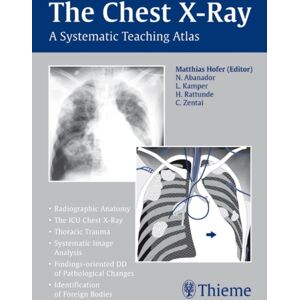 Thieme Publishing Group The Chest X-Ray : A Systematic Teaching Atlas Thieme Publishing Group The Chest X-Ray : A Systematic Teaching Atlas