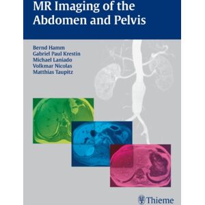 Thieme Publishing Group Mr Imaging Of The Abdomen And Pelvis Thieme Publishing Group Mr Imaging Of The Abdomen And Pelvis