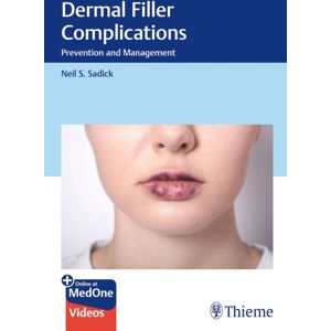 Thieme Publishing Group Dermal Filler Complications : Prevention And Management Thieme Publishing Group Dermal Filler Complications : Prevention And Management