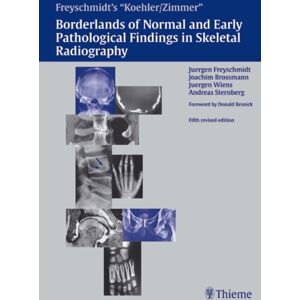 Thieme Publishing Group Freyschmidt'S "Koehler/zimmer" Borderlands Of Normal And Early Pathological Findings In Skeletal Radiography Thieme Publishing Group Freyschmidt'S "Koehler/zimmer" Borderlands Of Normal And Early Pathological Findings In Skeletal Radiography