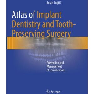 Springer International Publishing AG Atlas Of Implant Dentistry And Tooth-Preserving Surgery : Prevention And Management Of Complications Springer International Publishing AG Atlas Of Implant Dentistry And Tooth-Preserving Surgery : Prevention And Management Of Complications