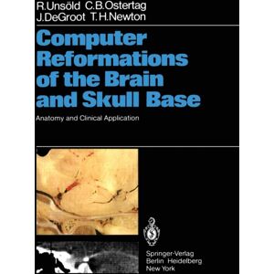Springer-Verlag Berlin and Heidelberg GmbH & Co. K Computer Reformations Of The Brain And Skull Base : Anatomy And Clinical Application Springer-Verlag Berlin and Heidelberg GmbH & Co. K Computer Reformations Of The Brain And Skull Base : Anatomy And Clinical Application