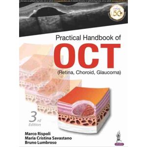 Jaypee Brothers Medical Publishers Practical Handbook Of Oct : (Retina, Choroid, Glaucoma) Jaypee Brothers Medical Publishers Practical Handbook Of Oct : (Retina, Choroid, Glaucoma)