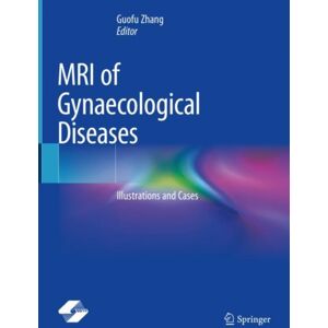 Springer Verlag, Singapore Mri Of Gynaecological Diseases : Illustrations And Cases Springer Verlag, Singapore Mri Of Gynaecological Diseases : Illustrations And Cases