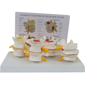 TLILY Four Stage Vertebrae Model, Human Anatomy and Physiology Educational Spine Doctor'S Office Model TLILY Four Stage Vertebrae Model, Human Anatomy and Physiology Educational Spine Doctor'S Office Model
