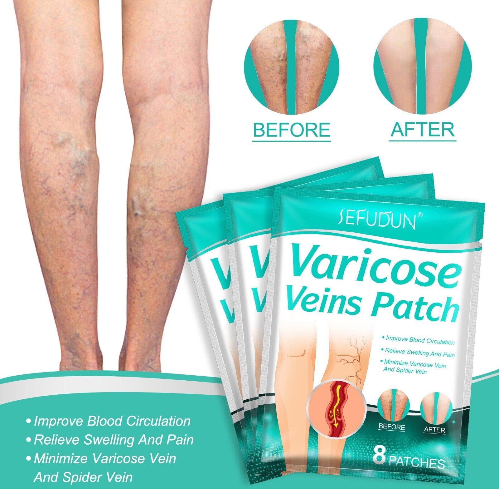 Herbal Patch Varicose Veins Patch Relief Leg Spider Vein Patches Veins For Legs Improve Blood Foot Health Care