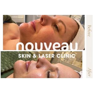 Nouveau Skin & Laser Clinic Choice Of Tailored 45 Minute Facial Nouveau Skin & Laser Clinic Choice Of Tailored 45 Minute Facial