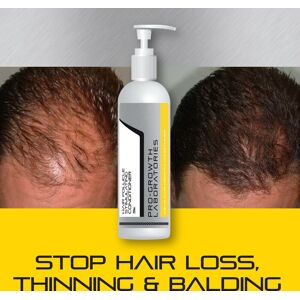 Pro Growth Mens Hair Follicle Stimulating Hair Grow Conditioner Thick Hair Pro Growth Mens Hair Follicle Stimulating Hair Grow Conditioner Thick Hair